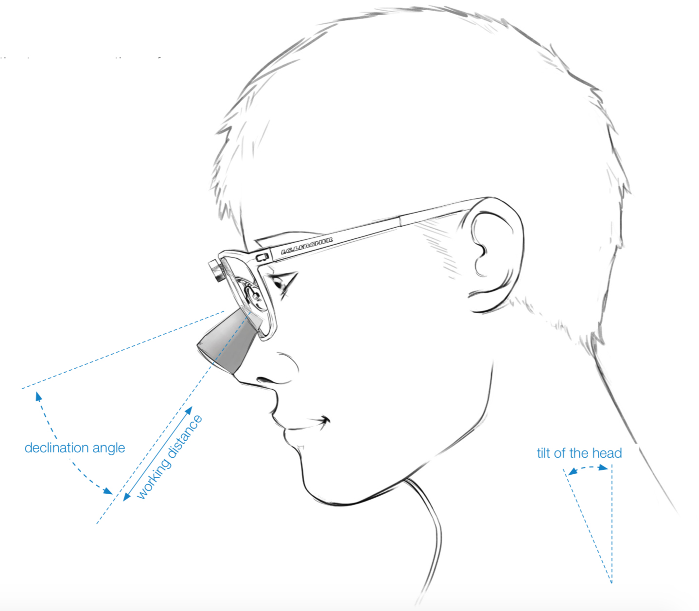 Hovedhældning ved dentale lupbriller